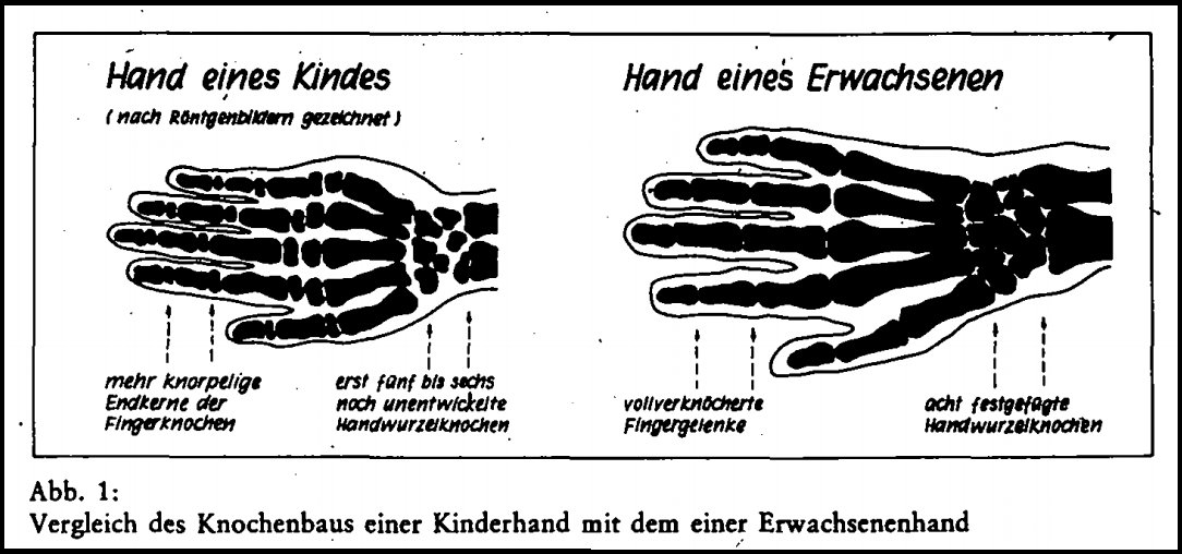 Knochhand